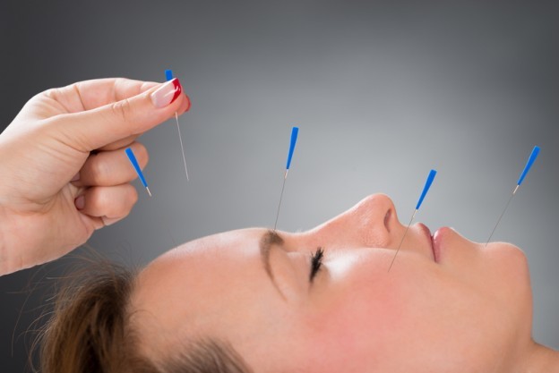acupuncture nj
