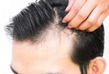 Hair Loss Six Best Natural Treatment For Thicker Hair