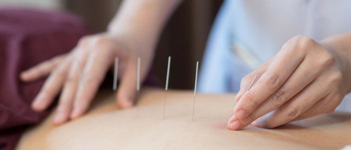 Acupuncture treatments used to treat different medical conditions