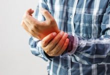 Know the Different Types of Arthritis Treatments