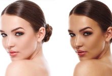 Understand How To Use Melanotan 2 Injections