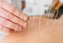 Get your best acupuncture needles from the bestsellers Needle Pro