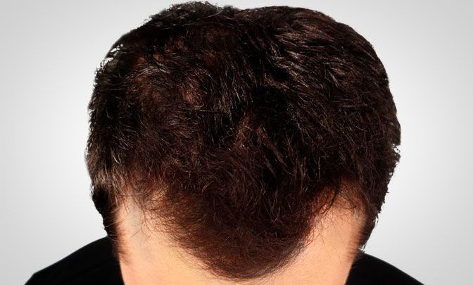 How Make Your Hair Fully Thicker And Fabulous