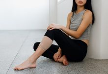 Correct Bow Legs