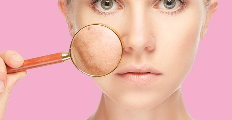 Pigmentation Removal Clinic